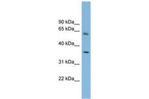 Image no. 1 for anti-Peroxisomal Biogenesis Factor 26 (PEX26) (AA 179-228) antibody (ABIN6744112) (PEX26 抗体  (AA 179-228))