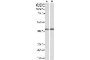 AP23750PU-N GNAQ antibody staining of Mouse (A) and Rat (B) Testis lysate at 0. (GNAQ 抗体  (Internal Region))