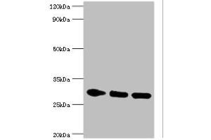 Western blot All lanes: PRKAB2 antibody at 5 μg/mL Lane 1: Rat brain tissue Lane 2: Mouse heart tissue Lane 3: Mouse gonad tissue Secondary Goat polyclonal to rabbit IgG at 1/10000 dilution Predicted band size: 31, 22 kDa Observed band size: 31 kDa (PRKAB2 抗体  (AA 1-272))