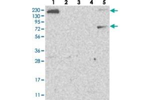 Western blot analysis of Lane 1: RT-4, Lane 2: U-251 MG, Lane 3: Human Plasma, Lane 4: Liver, Lane 5: Tonsil with FAM83H polyclonal antibody  at 1:250-1:500 dilution. (FAM83H 抗体)