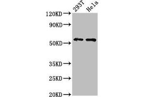 Western Blot Positive WB detected in: 293T whole cell lysate, Hela whole cell lysate All lanes: EPOR antibody at 4. (EPOR 抗体  (AA 320-506))