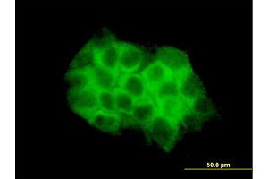 Immunofluorescence of monoclonal antibody to DVL3 on A-431 cell. (DVL3 抗体  (AA 1-100))