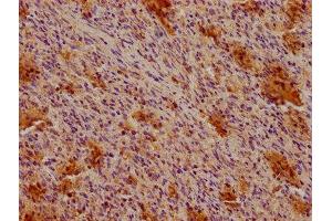 Immunohistochemistry (IHC) image for anti-CD19 Molecule (CD19) (AA 20-291) antibody (ABIN7147133)