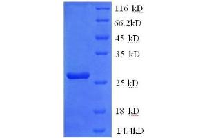 SDS-PAGE (SDS) image for Glutathione S-Transferase pi 1 (GSTP1) (AA 2-210), (full length) protein (His tag) (ABIN1047087)