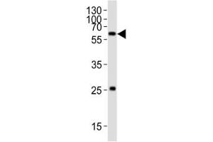 Western blot analysis of lysate from HT-1080 cell line using SMAD1 antibody