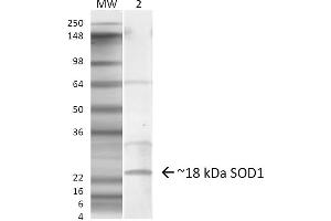 Western blot analysis of Mouse Lung showing detection of ~18 kDa SOD1 (EDI) protein using Rabbit Anti-SOD1 (EDI) Polyclonal Antibody . (SOD1 抗体  (C-Term) (PerCP))