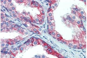 Prostate, Human: Formalin-Fixed, Paraffin-Embedded (FFPE) (PDIA4 抗体  (AA 623-638))