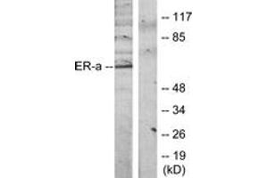 Western blot analysis of extracts from MCF7 cells, treated with Estradiol, using Estrogen Receptor-alpha (Ab-118) Antibody. (Estrogen Receptor alpha 抗体  (AA 91-140))