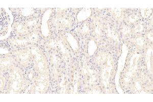 Detection of PAI1 in Human Kidney Tissue using Monoclonal Antibody to Plasminogen Activator Inhibitor 1 (PAI1) (PAI1 抗体)