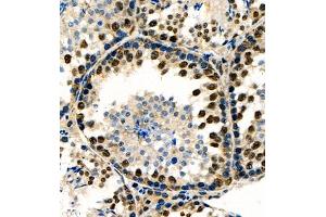 Immunohistochemistry of paraffin embedded rat testis using RNF7 (ABIN7075471) at dilution of 1:1000 (400x lens) (RNF7 抗体)