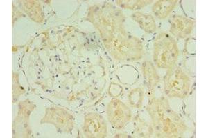 Immunohistochemistry of paraffin-embedded human kidney tissue using ABIN7170959 at dilution of 1:100 (SULT1C2 抗体  (AA 1-120))