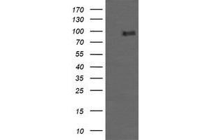 Image no. 2 for anti-Phosphoinositide-3-Kinase, Regulatory Subunit 5 (PIK3R5) antibody (ABIN1500214) (PIK3R5 抗体)