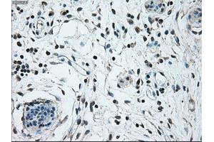 Immunohistochemical staining of paraffin-embedded breast tissue using anti-NRBP1 mouse monoclonal antibody. (NRBP1 抗体)