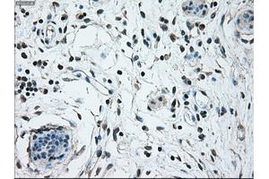 Immunohistochemical staining of paraffin-embedded breast tissue using anti-NRBP1 mouse monoclonal antibody.