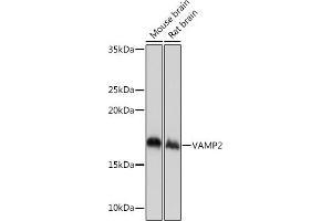 Western blot analysis of extracts of various cell lines, using V Rabbit mAb (ABIN7271313) at 1:1000 dilution. (VAMP2 抗体)
