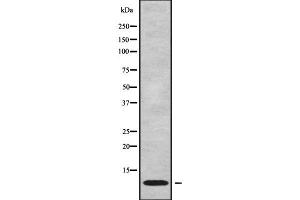 Western blot analysis NDUFC1 using Jurkat whole cell lysates (NDUFC1 抗体  (C-Term))