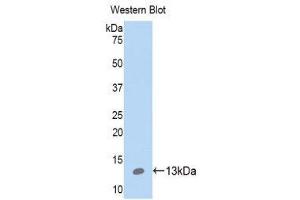 Western Blotting (WB) image for anti-S100 Calcium Binding Protein A10 (S100A10) (AA 1-96) antibody (ABIN1078494) (S100A10 抗体  (AA 1-96))