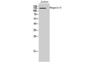 Western Blotting (WB) image for anti-Chromosome 14 Open Reading Frame 49 (C14orf49) (Internal Region) antibody (ABIN3185823) (Nesprin3 抗体  (Internal Region))