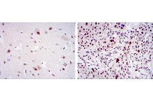 Immunohistochemistry (IHC) image for anti-Cyclin-Dependent Kinase 9 (CDK9) antibody (ABIN969042)