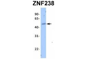 Host:  Rabbit  Target Name:  ZNF238  Sample Type:  Human Fetal Heart  Antibody Dilution:  1. (ZNF238 抗体  (N-Term))