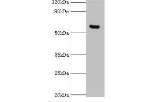 Western blot All lanes: MKS1 antibody at 6 μg/mL + Hela whole cell lysate Secondary Goat polyclonal to rabbit IgG at 1/10000 dilution Predicted band size: 65, 60, 64 kDa Observed band size: 65 kDa (MKS1 抗体  (AA 150-300))