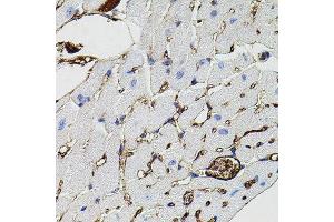 Immunohistochemistry of paraffin-embedded mouse heart using MMP9 antibody. (MMP 9 抗体)