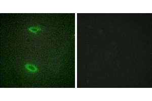Peptide - +Western blot analysis of extracts from HepG2 cells, using DLGP1 antibody. (DLGAP1 抗体  (Internal Region))