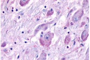 Immunohistochemical staining of human brain with CELSR1 polyclonal antibody . (CELSR1 抗体  (N-Term))