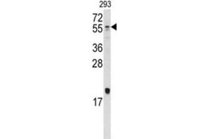 Western Blotting (WB) image for anti-Bone Morphogenetic Protein 10 (BMP10) antibody (ABIN5018806) (BMP10 抗体)