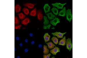 IL4I1 Antibody staining HepG2 cells by IF/ICC. (IL4I1 抗体  (C-Term))