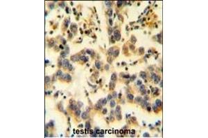 Immunohistochemistry (Paraffin-embedded Sections) (IHC (p)) image for anti-KIAA0090 (KIAA0090) (AA 866-894), (C-Term) antibody (ABIN654184)