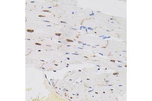 Immunohistochemistry of paraffin-embedded rat heart using FAF1 antibody (ABIN5975642) (40x lens). (FAF1 抗体)