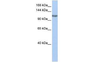 WB Suggested Anti-TGS1 Antibody Titration:  0. (TGS1 抗体  (Middle Region))