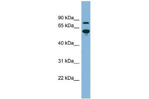 ABCF2 antibody used at 1 ug/ml to detect target protein. (ABCF2 抗体)