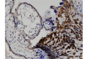 Immunoperoxidase of monoclonal antibody to LIMA1 on formalin-fixed paraffin-embedded human placenta. (LIMA1 抗体  (AA 1-598))