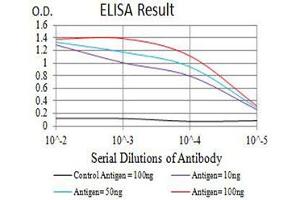 Black line: Control Antigen (100 ng),Purple line: Antigen (10 ng), Blue line: Antigen (50 ng), Red line:Antigen (100 ng) (BCL6 抗体  (AA 147-276))
