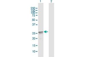 Western Blot analysis of C17orf66 expression in transfected 293T cell line by C17orf66 MaxPab polyclonal antibody. (C17orf66 抗体  (AA 1-219))