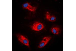 Immunofluorescent analysis of S6K1 (pS434) staining in K562 cells. (RPS6KB1 抗体  (C-Term, pSer434))