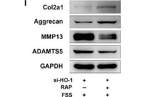 Rapamycin regulates autophagy and ECM in NP cells. (COL2A1 抗体  (AA 873-1072))