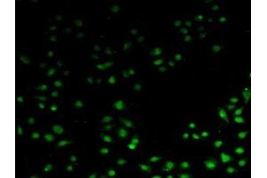 Detection of API5 in Human Hela Cells using Polyclonal Antibody to Apoptosis Inhibitor 5 (API5) (Apoptosis Inhibitor 5 抗体  (AA 2-360))