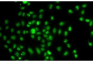 Immunofluorescence analysis of A549 cells using FOXN2 Polyclonal Antibody (FOXN2 抗体)