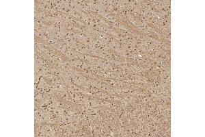 IHC analysis of Sm-D3/SNRPD3 using anti-Sm-D3/SNRPD3 antibody (ABIN7598952). (SNRPD3 抗体  (AA 1-112))