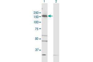 Western Blotting (WB) image for anti-TBC1 (Tre-2/USP6, BUB2, Cdc16) Domain Family, Member 1 (TBC1D1) (AA 1-1168) antibody (ABIN949094)