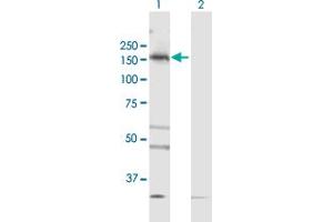 Western Blot analysis of TBC1D1 expression in transfected 293T cell line by TBC1D1 MaxPab polyclonal antibody. (TBC1D1 抗体  (AA 1-1168))