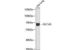 Western blot analysis of extracts of rat lung, using SLC1 antibody (ABIN6128765, ABIN6147874, ABIN6147876 and ABIN6216404) at 1:1000 dilution. (SLC1A5 抗体  (AA 1-100))