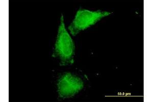 Immunofluorescence of purified MaxPab antibody to UMOD on HeLa cell. (Uromodulin 抗体  (AA 1-611))