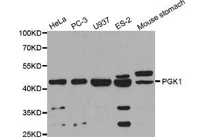 Western blot analysis of extracts of various cell lines, using PGK1 antibody (ABIN5971017) at 1/1000 dilution. (PGK1 抗体)
