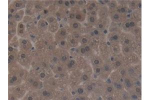 Detection of SIRT3 in Mouse Liver Tissue using Polyclonal Antibody to Sirtuin 3 (SIRT3) (SIRT3 抗体  (AA 5-257))