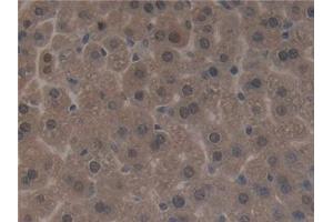 Detection of SIRT3 in Mouse Liver Tissue using Polyclonal Antibody to Sirtuin 3 (SIRT3)