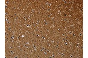 The image on the left is immunohistochemistry of paraffin-embedded Human brain tissue using ABIN7191586(NCKAP1 Antibody) at dilution 1/30, on the right is treated with synthetic peptide.